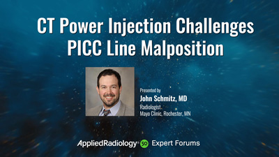 CT Power Injection Challenges | PICC Line Malposition